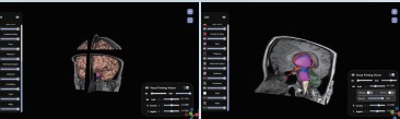 Bàn giải phẫu Medipbox 3D